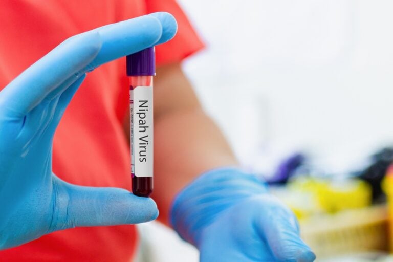 WhatsApp Image 2026-03-17 at 17.19.54